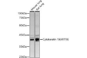 Western blot analysis of extracts of various cell lines, using Cytokeratin 19 (KRT19) antibody (ABIN3020778, ABIN3020779, ABIN3020780 and ABIN6213719) at 1:500 dilution. (Cytokeratin 19 anticorps  (AA 241-400))