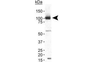 Western blot analysis of TRPA1 in human brain membrane fraction with TRPA1 polyclonal antibody at 2 ug/mL . (TRPA1 anticorps  (AA 1-100))