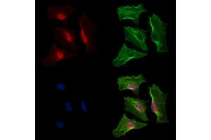 Phospho-Bcl6 (Ser333) Antibody staining A549 cells(heat shock treatment) by IF/ICC. (BCL6 anticorps  (pSer333))