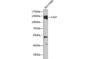 Western blot analysis of extracts of H460 cells, using CAST antibody (ABIN3015047, ABIN3015048, ABIN5663576 and ABIN6213614) at 1:1000 dilution. (Calpastatin anticorps  (C-Term))