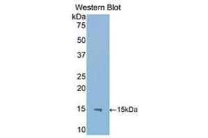 Western Blotting (WB) image for anti-Interleukin 13 Receptor, alpha 2 (IL13RA2) (AA 228-338) antibody (ABIN1859341) (IL13RA2 anticorps  (AA 228-338))