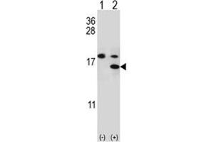 Western blot analysis of S100A11 antibody and 293 cell lysate either nontransfected (Lane 1) or transiently transfected (2) with the S100A11 gene. (S100A11 anticorps  (AA 1-30))
