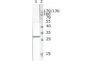 Western Blot testing of HIV-1 recombinant Nef protein. (HIV-1 Nef (AA 171-190) anticorps)