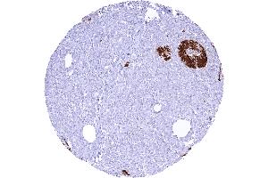 Pancreas with strong cytoplasmic C peptide staining of most islet cells