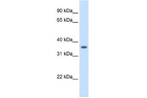 AKR1B10 antibody used at 1. (AKR1B10 anticorps)