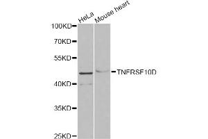 Western blot analysis of extracts of various cell lines, using TNFRSF10D antibody (ABIN5973614) at 1/1000 dilution. (DcR2 anticorps)