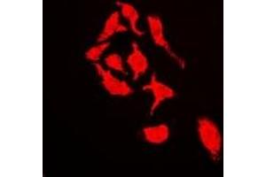 Immunofluorescent analysis of Cullin 4A staining in U2OS cells.