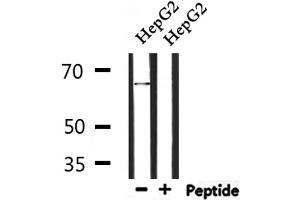 Western blot analysis of extracts from HepG2, using ATIC Antibody. (ATIC anticorps  (C-Term))