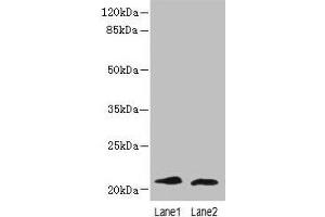 Western blot All lanes: LRRC20 antibody at 1 μg/mL Lane 1: Jurkat whole cell lysate Lane 2: Mouse spleen tissue Secondary Goat polyclonal to rabbit IgG at 1/10000 dilution Predicted band size: 21, 15 kDa Observed band size: 21 kDa (LRRC2 anticorps  (AA 1-184))