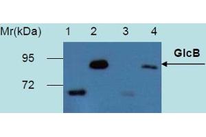 Western Blotting analysis of recombinant protein GlcB produced in Escherichia coli BL21 (lambdaDE3) transfected bacterial culture. (GlcB (M. Tuberculosis) anticorps)