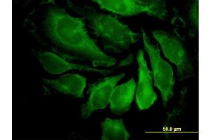 Immunofluorescence of monoclonal antibody to PAK1 on HeLa cell.