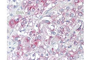 Anti-KCNH3 antibody IHC of human adrenal.