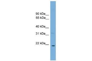 Western Blot showing CTF1 antibody used at a concentration of 1-2 ug/ml to detect its target protein.