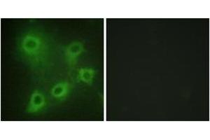 Immunofluorescence (IF) image for anti-Spleen tyrosine Kinase (SYK) (AA 289-338) antibody (ABIN2888703) (SYK anticorps  (AA 289-338))