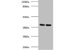 Western blot All lanes: Antigen 85-A antibody at 2 μg/mL Lane 1: Recombinant Mycobacterium tuberculosis Antigen 85-A protein 1 μg Lane 2: Recombinant Mycobacterium tuberculosis Antigen 85-A protein 10 μg Secondary Goat polyclonal to rabbit IgG at 1/10000 dilution Predicted band size: 36 kDa Observed band size: 36 kDa (FBPA (AA 53-331) anticorps)