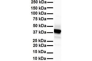 WB Suggested Anti-SLC6A5 antibody Titration: 1 ug/mL Sample Type: Human heart (SLC6A5 anticorps  (N-Term))