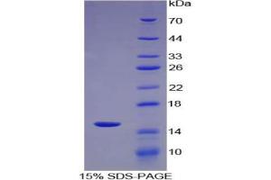 SDS-PAGE analysis of Mouse PLA2G2D Protein. (PLA2G2D Protéine)
