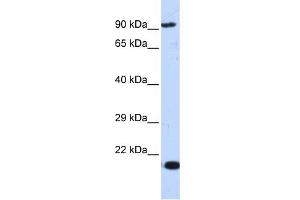 WB Suggested Anti-MCM7 Antibody Titration:  0. (MCM7 anticorps  (Middle Region))