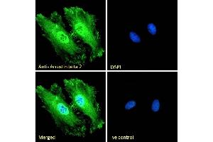 (ABIN185395) Immunofluorescence analysis of paraformaldehyde fixed HeLa cells, permeabilized with 0.
