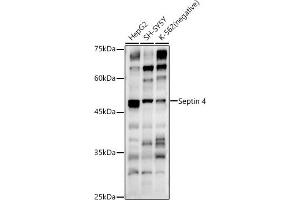 Western blot analysis of extracts of various cell lines, using Septin 4 antibody (ABIN6128476, ABIN6147554, ABIN6147555 and ABIN6214410) at 1:500 dilution. (Septin 4 anticorps  (AA 1-100))