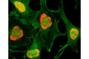 ICC testing of HeLa cells treated with sodium butyrate using recombinant H3K79ac antibody (red). (Recombinant Histone 3 anticorps  (acLys79))