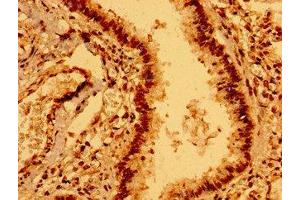 Immunohistochemistry of paraffin-embedded human lung tissue using ABIN7151731 at dilution of 1:100