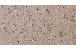 Immunohistochemistry of paraffin-embedded Human brain tissue using MED12 Polyclonal Antibody at dilution 1:40 (MED12 anticorps)