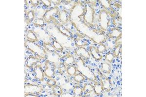 Immunohistochemistry of paraffin-embedded mouse kidney using DEPDC6 antibody (ABIN7266738) at dilution of 1:200 (40x lens). (DEPTOR anticorps  (AA 1-220))