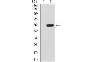 Western Blotting (WB) image for anti-Methyl CpG Binding Protein 2 (MECP2) (AA 7-148) antibody (ABIN5889789) (MECP2 anticorps  (AA 7-148))