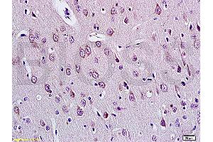 Formalin-fixed and paraffin embedded rat brain tissue labeled with Anti-E2F1 Polyclonal Antibody (ABIN670686), Unconjugated at 1:200, followed by conjugation to the secondary antibody and DAB staining (E2F1 anticorps  (AA 101-180))
