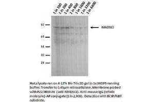 Image no. 2 for anti-Proteasome (Prosome, Macropain) 26S Subunit, Non-ATPase, 14 (PSMD14) antibody (ABIN108607) (PSMD14 anticorps)