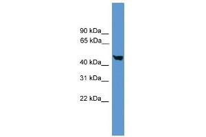 WB Suggested Anti-CASP5 Antibody Titration: 0. (CASP5 anticorps  (Middle Region))