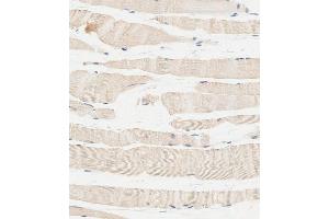 Immunohistochemical analysis of paraffin-embedded human skeletal muscle tissue using C performed on the Leica® BOND RXm. (Glucosylceramidase anticorps  (Center))