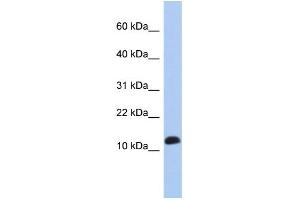 WB Suggested Anti-RPL30 Antibody Titration: 0. (RPL30 anticorps  (Middle Region))