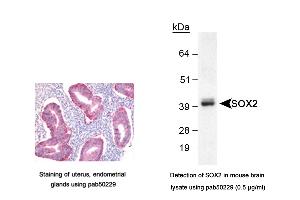 Image no. 3 for anti-SRY (Sex Determining Region Y)-Box 2 (SOX2) (AA 1-100), (N-Term) antibody (ABIN363538) (SOX2 anticorps  (N-Term))