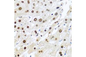 Immunohistochemistry of paraffin-embedded human liver using METTL3 antibody. (METTL3 anticorps)