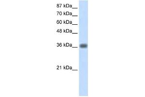 KLHDC8A antibody used at 1. (KLHDC8A anticorps  (C-Term))