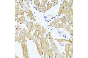 Immunohistochemistry of paraffin-embedded rat heart using SLC2A4 antibody.