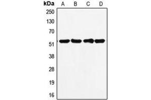 Western blot analysis of p53 expression in MDAMB231 (A), HepG2 (B), MCF7 (C), A431 (D) whole cell lysates. (p53 anticorps  (C-Term))