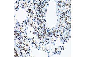 Immunohistochemistry of paraffin-embedded rat lung using SNRP Rabbit pAb (2161) at dilution of 1:200 (40x lens). (SNRPA1 anticorps  (AA 1-220))