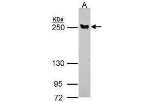 WB Image LTBP4 antibody [N1N2], N-term detects LTBP4 protein by Western blot analysis.
