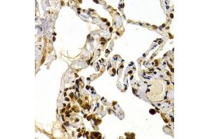Immunohistochemistry of paraffin-embedded human lung using TFDP1 antibody (ABIN5973148) at dilution of 1/200 (40x lens). (DP1 anticorps)