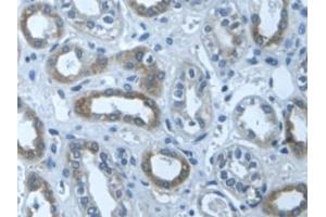 Detection of TGFbI in Human Kidney Tissue using Polyclonal Antibody to Transforming Growth Factor Beta Induced Protein (TGFbI)