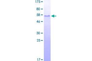Image no. 1 for Erythrocyte Membrane Protein Band 4.1 (Elliptocytosis 1, RH-Linked) (EPB41) (AA 116-225) protein (GST tag) (ABIN1352876)