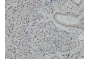 Immunoperoxidase of monoclonal antibody to NFKB1 on formalin-fixed paraffin-embedded human salivary gland.