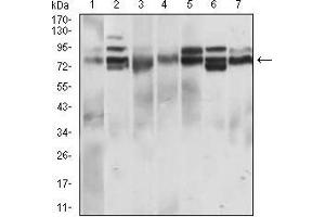 Western blot analysis using CD22 mouse mAb against L1210 (1), Hela (2), HEK293 (3), Jurkat (4), OCM-1 (5), A432 (6) and NIH/3T3 (7) cell lysate.