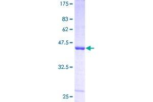 SDS-PAGE (SDS) image for Spermidine/spermine N1-Acetyltransferase 1 (SAT1) (AA 1-171) protein (GST tag) (ABIN1319172)