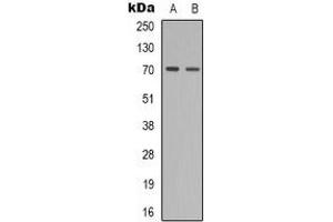 Western blot analysis of ZAP70 (pY319) expression in SHSY5Y (A), Jurkat (B) whole cell lysates. (ZAP70 anticorps  (pTyr319))