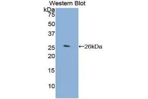 Western blot analysis of the recombinant protein. (Orosomucoid 2 anticorps  (AA 19-207))