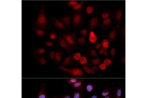 Immunofluorescence analysis of MCF-7 cells using Phospho-ABL1(Y412) Polyclonal Antibody (ABL1 anticorps  (pTyr412))